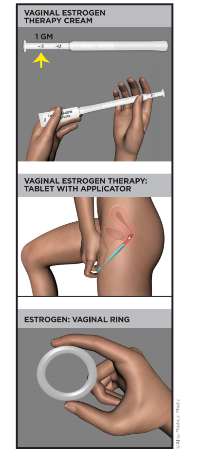 Screenshot 89 - Vaginal Estrogen Therapy 1