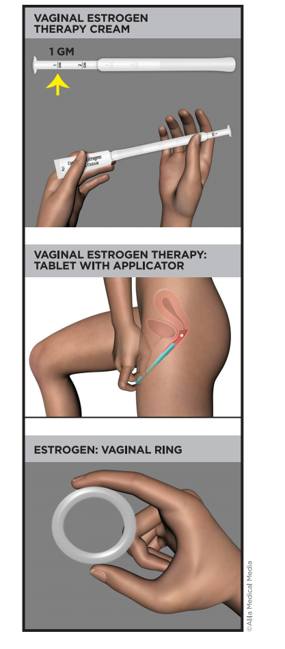 Vaginal Estrogen: Is it Safe? How Should it Be Used? - ppt video online  download